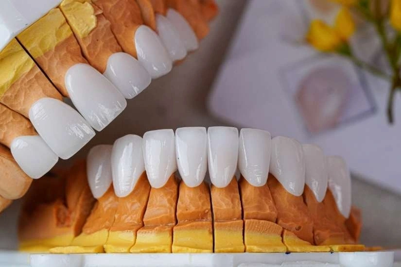 Porcelain Dental Restoration – Regain Your Natural, Confident Smile with Vietnam Dental Travel